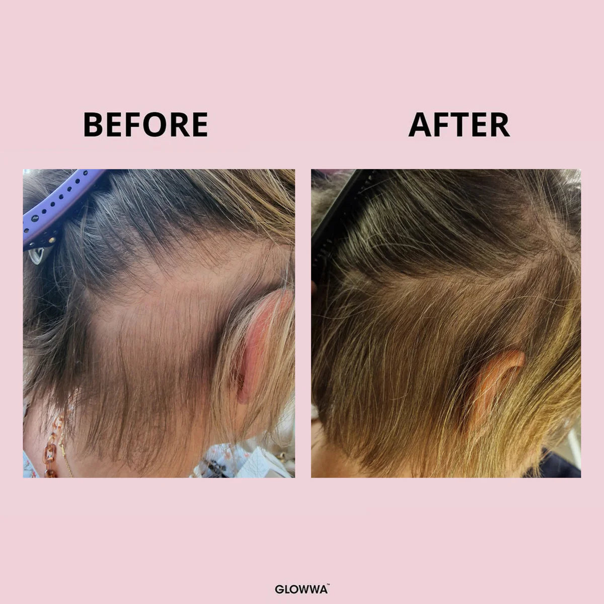 Glowwa Hair Food Original
