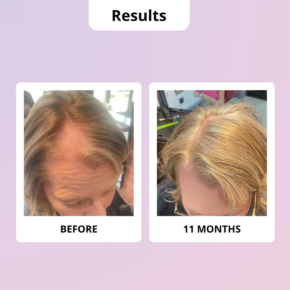 Glowwa Hair Food Meno